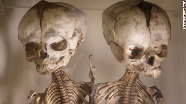 This London museum houses nearly 5,000 medical oddities, including random objects pulled from human bodies over the past 150 years -- toothbrush in the esophagus, anyone?