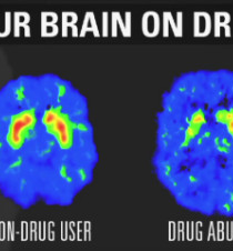 How addiction changes your brain - CNN Video