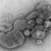 First H5N1 avian flu death in North America - CNN.com