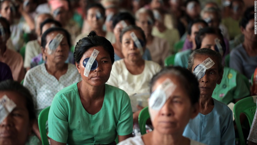 بالصور: طبيب نيبالي يعيد البصر لألاف الأشخاص في زمن قياسي!