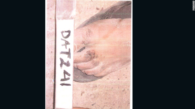 Пентагон опубликовал фото пыток в тюрьмах Ирака и Афганистана
