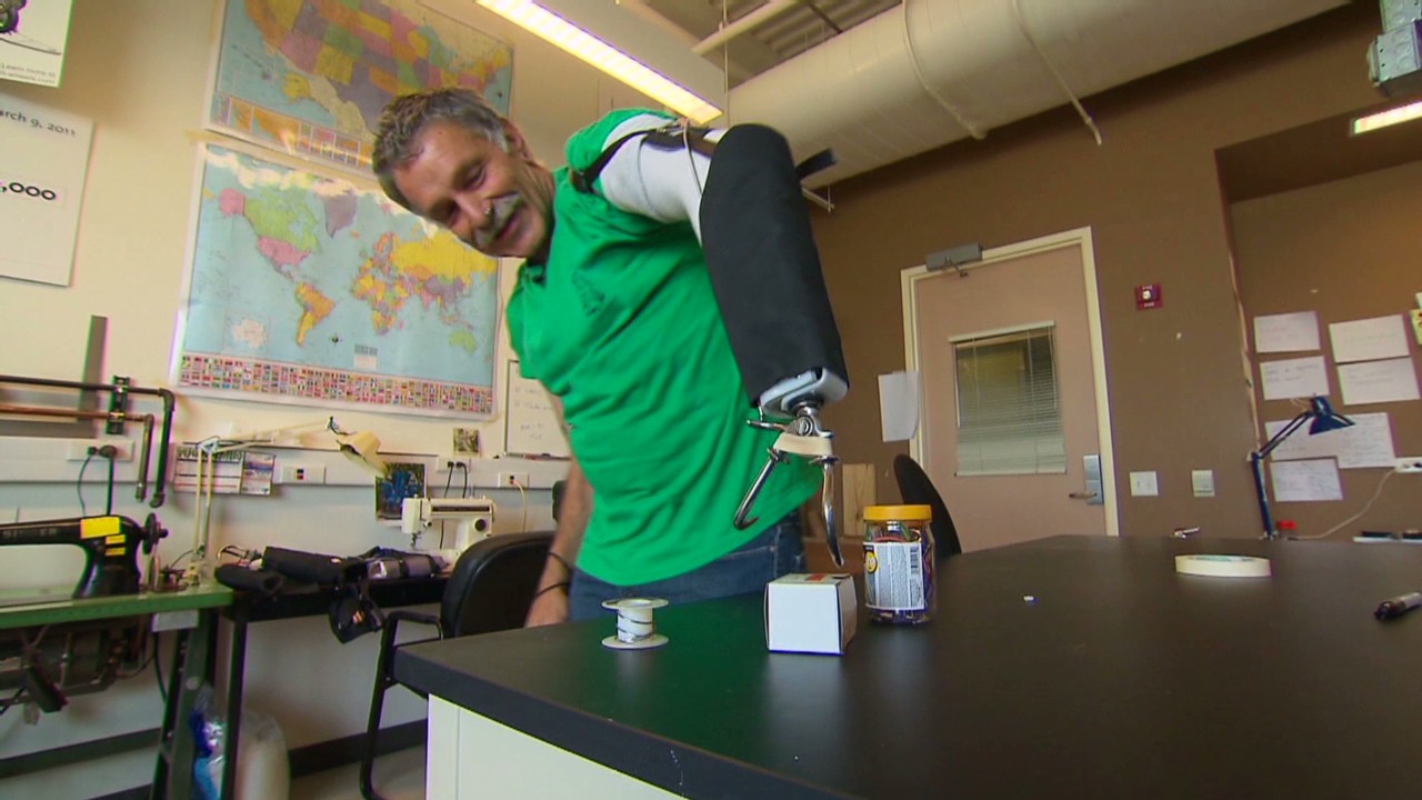 the-300-prosthetic-arm-video-technology