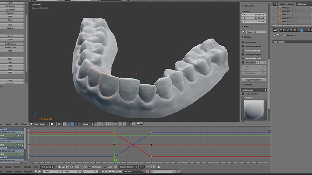 How to make your own braces on a budget