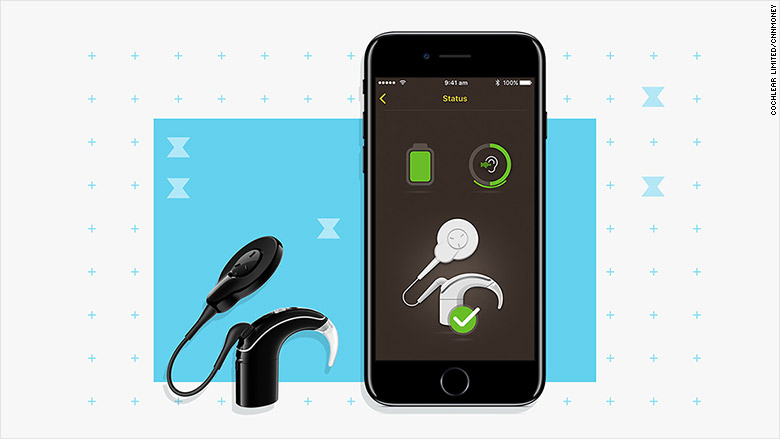 Apple and Cochlear Team Up to introduce Cochlear Hearing Device for iPhone - 43