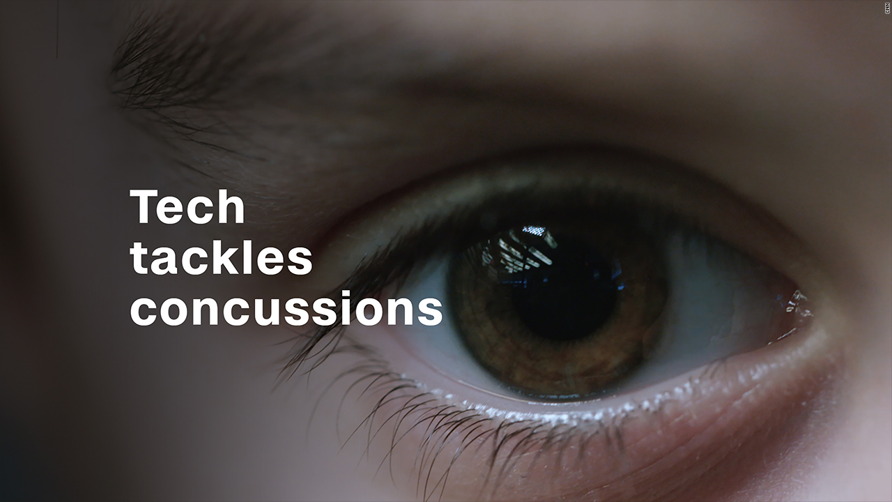 concussion flickery eyesight